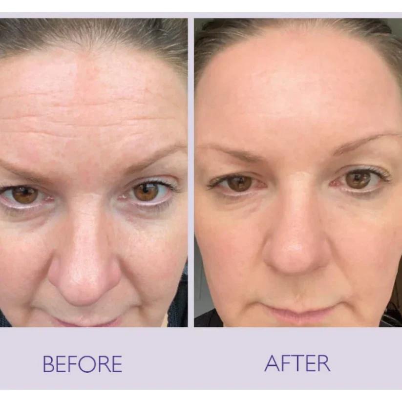 Celimax Retinal Shot Tightening Booster