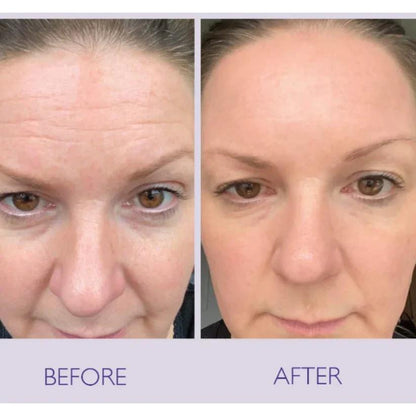 Celimax Retinal Shot Tightening Booster