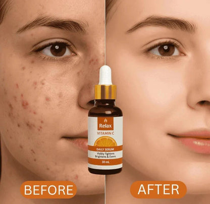 Relax Vitamin C Daily Serum 30ml | Brightening, Tightening & Even Skin Tone Formula